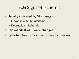 ECG Signs of Ischemia
• Usually indicated by ST changes
– Elevation = Acute infarction
– Depression = Ischemia
• Can manifest as T wave changes
• Remote infarction can be shown by q waves
90
 