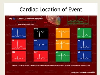 Cardiac Location of Event
97
 