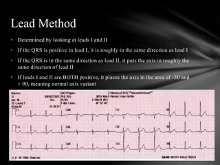12 lead interpretation | PPTX