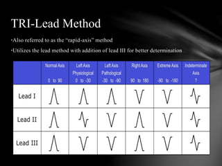 12 lead interpretation | PPTX