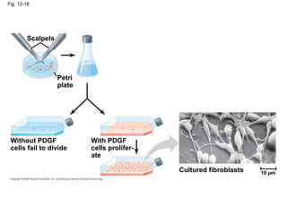 Fig. 12-18
Petri
plate
Scalpels
Cultured fibroblasts
Without PDGF
cells fail to divide
With PDGF
cells prolifer-
ate
10 µm
 
