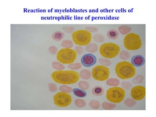 Reaction of myeloblastes and other cells of
neutrophilic line of peroxidase
 