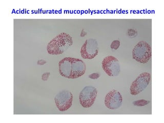 Acidic sulfurated mucopolysaccharides reaction
 