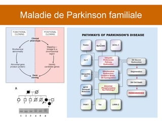 Maladie de Parkinson familiale 