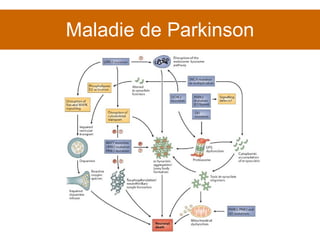 Maladie de Parkinson 