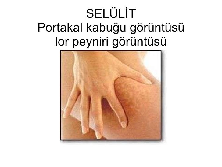 Ece Klinik Selulit Sunumu