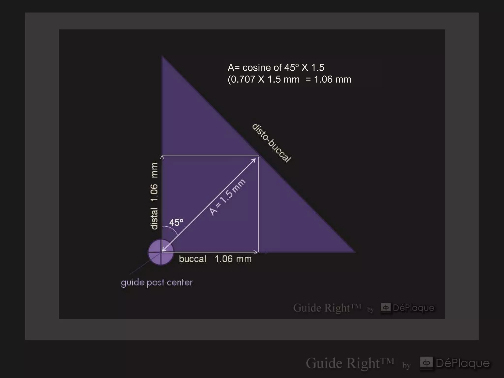A= cosine of 45º X 1.5
(0.707 X 1.5 mm = 1.06 mm
 