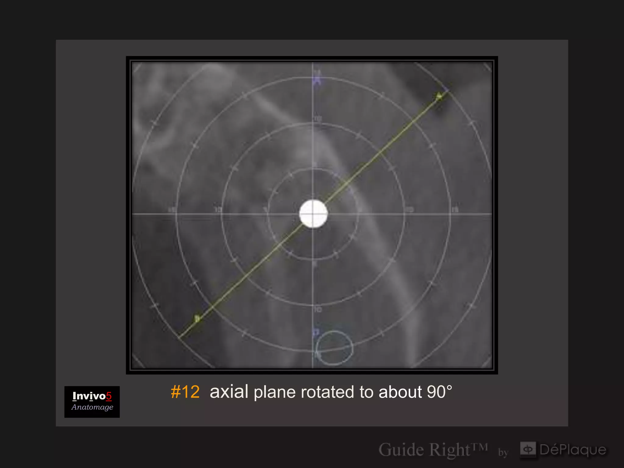 Invivo5     #12 axial plane rotated to about 90°
Anatomage
 