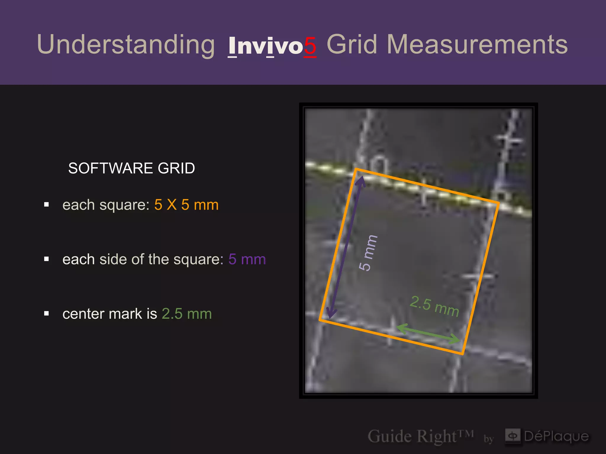 Understanding Invivo5 Grid Measurements



   SOFTWARE GRID

 each square: 5 X 5 mm


 each side of the square: 5 mm


 center mark is 2.5 mm


                                  tangential
 