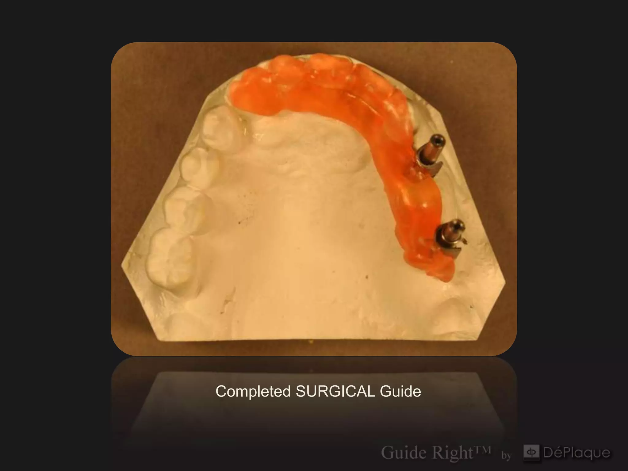 Completed SURGICAL Guide
 