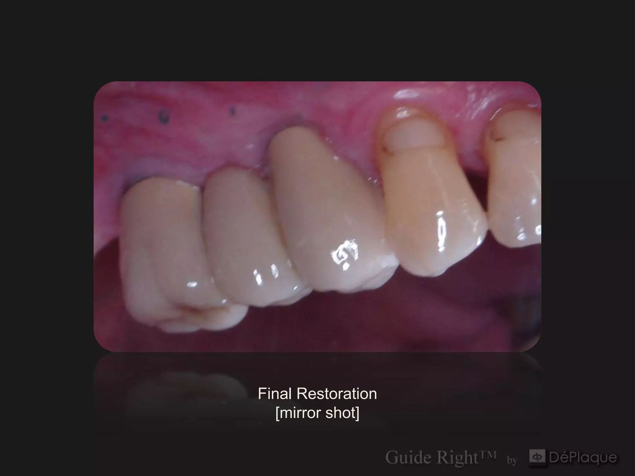 Final Restoration
  [mirror shot]
 