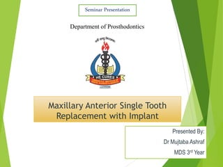 Maxillary Anterior Single Tooth
Replacement with Implant
Presented By:
Dr Mujtaba Ashraf
MDS 3rd Year
Seminar Presentation
Department of Prosthodontics
 