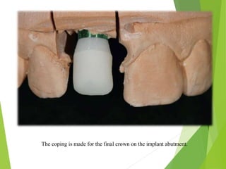 The coping is made for the final crown on the implant abutment.
 