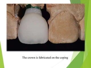 The crown is fabricated on the coping
 