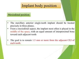 Implant body position
Mesiodistal position
• The maxillary anterior single-tooth implant should be located
precisely in three planes.
• From a mesiodistal aspect, the implant most often is placed in the
middle of the space, with an equal amount of interproximal bone
toward each adjacent tooth
• The goal is to remain 1.5 mm or more from the adjacent CEJ of
each tooth.
 
