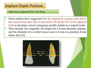 Implant Depth Position
• Some authors have suggested that the implant be counter sunk below
the crestal bone more than 4 mm below the facial CEJ of the adjacent
teeth to develop a crown emergence profile similar to a natural tooth.
• This concept was originally developed for a 4-mm-diameter implant,
and the diameter of a central incisor root is 4 mm at a position 4 mm
below the CEJ.
>4mm from adjacent CEJ/ Too Deep
 