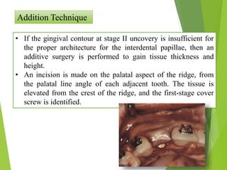 Addition Technique
• If the gingival contour at stage II uncovery is insufficient for
the proper architecture for the interdental papillae, then an
additive surgery is performed to gain tissue thickness and
height.
• An incision is made on the palatal aspect of the ridge, from
the palatal line angle of each adjacent tooth. The tissue is
elevated from the crest of the ridge, and the first-stage cover
screw is identified.
 