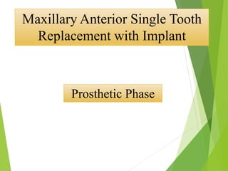 Prosthetic Phase
Maxillary Anterior Single Tooth
Replacement with Implant
 