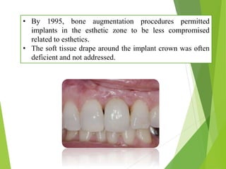 • By 1995, bone augmentation procedures permitted
implants in the esthetic zone to be less compromised
related to esthetics.
• The soft tissue drape around the implant crown was often
deficient and not addressed.
 