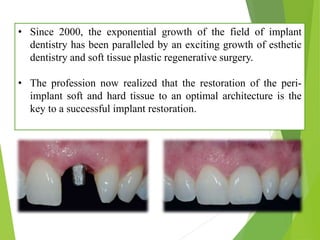 • Since 2000, the exponential growth of the field of implant
dentistry has been paralleled by an exciting growth of esthetic
dentistry and soft tissue plastic regenerative surgery.
• The profession now realized that the restoration of the peri-
implant soft and hard tissue to an optimal architecture is the
key to a successful implant restoration.
 