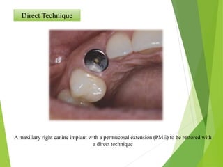 Direct Technique
A maxillary right canine implant with a permucosal extension (PME) to be restored with
a direct technique
 
