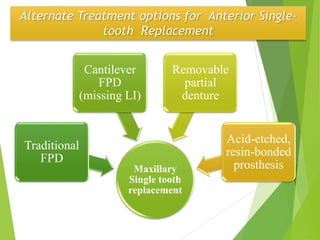 Alternate Treatment options for Anterior Single-
tooth Replacement
Maxillary
Single tooth
replacement
Traditional
FPD
Cantilever
FPD
(missing LI)
Removable
partial
denture
Acid-etched,
resin-bonded
prosthesis
 
