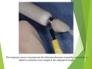The temporary crown is inserted onto the lubricated abutment extraorally, and acrylic is
added to extend the crown margin to the subgingival margin
 