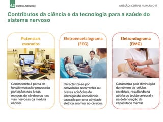 4.2 SISTEMA NERVOSO MISSÃO: CORPO HUMANO 9
Contributos da ciência e da tecnologia para a saúde do
sistema nervoso
Potenciais
evocados
Eletroencefalograma
(EEG)
Eletromiograma
(EMG)
Corresponde à perda de
função muscular provocada
por lesões nas áreas
motoras do cérebro ou nas
vias nervosas da medula
espinal.
Caracteriza-se por
convulsões recorrentes ou
breves episódios de
alteração da consciência
causada por uma atividade
elétrica anormal no cérebro.
Caracteriza pela diminuição
do número de células
cerebrais, resultando na
atrofia do tecido cerebral e
na deterioração da
capacidade mental.
 