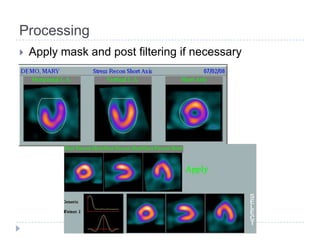 Processing
 Apply mask and post filtering if necessary
 