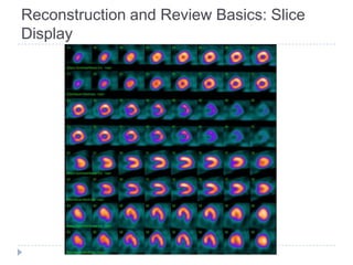 Reconstruction and Review Basics: Slice
Display
 