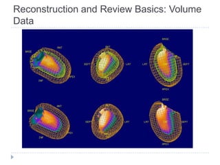 Reconstruction and Review Basics: Volume
Data
 