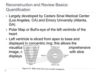 Reconstruction and Review Basics:
Quantification
 Largely developed by Cedars Sinai Medical Center
(Los Angeles, CA) and Emory University (Atlanta,
GA)
 Polar Map or Bull's-eye of the left ventricle of the
heart
 Left ventricle is sliced from apex to base and
displayed in concentric ring; this allows the
visualization of the left ventricle in a comprehensive
image, rather than multiple images as with slice
displays
 
