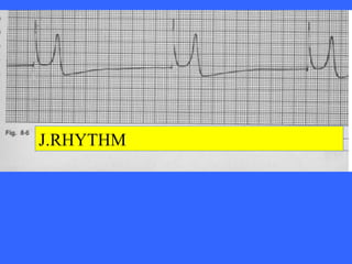 12O of ECG for learning and practicing cardiolog | PPT