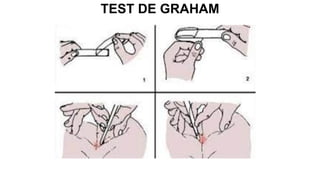 TEST DE GRAHAM
 