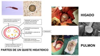 HIGADO
PULMON
PARTES DE UN QUISTE HIDATIDICO
 