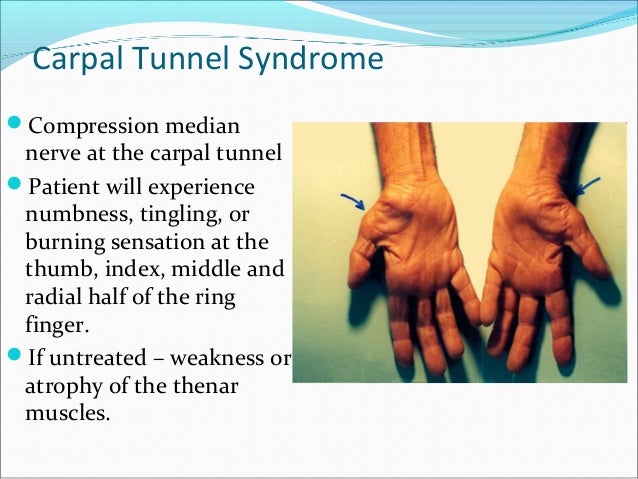 pronator syndrome pronator syndrome