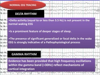 NORMAL EEG TRACING
NORMALRHYTHM
DELTA EEG TRACING

•Delta activity (equal to or less than 3.5 Hz) is not present in the
normal waking EEG
•Is a prominent feature of deeper stages of sleep.
•The presence of significant generalized or focal delta in the wake
EEG is strongly indicative of a Pathophysiological process

GAMMA RHYTHM

Evidence has been provided that high frequency oscillations
within the gamma band (>30Hz) reflect mechanisms of
cortical integration

 
