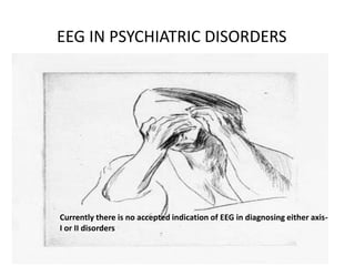 EEG IN PSYCHIATRIC DISORDERS

Currently there is no accepted indication of EEG in diagnosing either axisI or II disorders

 