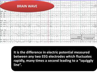 BRAIN WAVE

It is the difference in electric potential measured
between any two EEG electrodes which fluctuates
rapidly, many times a second leading to a “squiggly
line”.

 