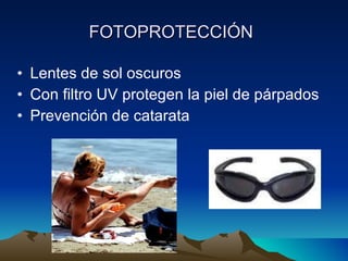 FOTOPROTECCI ÓN   Lentes de sol oscuros Con filtro UV protegen la piel de p árpados Prevención de catarata 