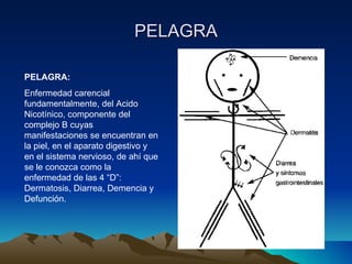 PELAGRA PELAGRA: Enfermedad carencial fundamentalmente, del Acido Nicotínico, componente del complejo B cuyas manifestaciones se encuentran en la piel, en el aparato digestivo y en el sistema nervioso, de ahí que se le conozca como la enfermedad de las 4 “D”: Dermatosis, Diarrea, Demencia y Defunción. 