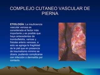 COMPLEJO CUTANEO VASCULAR DE PIERNA ETIOLOGÍA : La insuficiencia vascular venosa es considerada el factor más importante y es posible que haya antecedentes de tromboflebitis, varices y fístulas arterio venosas, a esto se agrega la fragilidad de la piel que en presencia de traumatismo mínimo se úlcera, pudiendo complicarse con infección o dermatitis por contacto. 