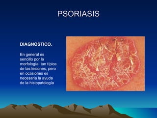 PSORIASIS DIAGNOSTICO. En general es sencillo por la morfología  tan típica de las lesiones, pero en ocasiones es necesaria la ayuda de la histopatología 