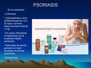 PSORIASIS Se ha empleado: Colchicina Antimetabolitos como el Metrotrexate de 10 a 35 mgs x semana hasta una dosis total de 1.5 gr. En casos refractarios al tratamiento se ha empleado diálisis peritoneal Retinoides de acción general con buen resultado en formas pustulosas. Ciclosporina. 