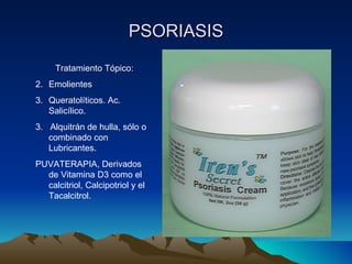 PSORIASIS Tratamiento Tópico: Emolientes Queratolíticos. Ac. Salicílico. 3.  Alquitrán de hulla, sólo o combinado con Lubricantes. PUVATERAPIA, Derivados de Vitamina D3 como el calcitriol, Calcipotriol y el Tacalcitrol. 