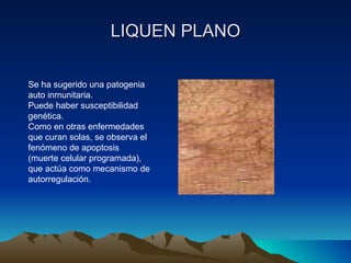 LIQUEN PLANO Se ha sugerido una patogenia auto inmunitaria. Puede haber susceptibilidad genética. Como en otras enfermedades que curan solas, se observa el fenómeno de apoptosis (muerte celular programada), que actúa como mecanismo de autorregulación. 