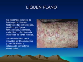 LIQUEN PLANO Se desconoce la causa, se han sugerido diversos factores de tipo inmunológico, genético, psicógeno, farmacológico, enzimático, metabólico o infeccioso o la interacción de varios factores. Se han observado casos inducidos por D-penicilamina y otros fármacos, y relacionado con factores emocionales. 