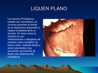 LIQUEN PLANO Los factores Psicógenos pueden ser importantes, en muchos pacientes el estrés es el mecanismo disparador y mejora el padecimiento al aliviarlo. En otros casos la relación es con medicamentos o alergénos de contacto como revelador de fotos a color, material dental y amino glucósidos, hay asociación aumentada de liquen con vitaminas del complejo B. 