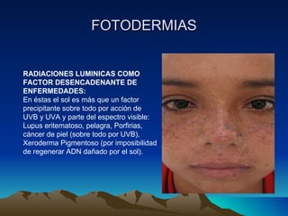 FOTODERMIAS RADIACIONES LUMINICAS COMO FACTOR DESENCADENANTE DE ENFERMEDADES: En éstas el sol es más que un factor precipitante sobre todo por acción de UVB y UVA y parte del espectro visible: Lupus eritematoso, pelagra, Porfirias, cáncer de piel (sobre todo por UVB), Xeroderma Pigmentoso (por imposibilidad de regenerar ADN dañado por el sol). 