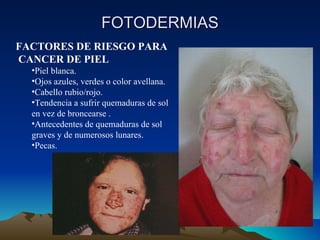 FOTODERMIAS FACTORES DE RIESGO PARA  CANCER DE PIEL Piel blanca.   Ojos azules, verdes o color avellana.   Cabello rubio/rojo.   Tendencia a sufrir quemaduras de sol en vez de broncearse  . Antecedentes de quemaduras de sol graves y de numerosos lunares . Pecas.   